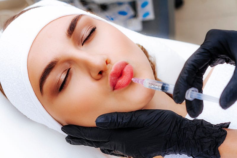 Non-Surgical Lip Augmentation