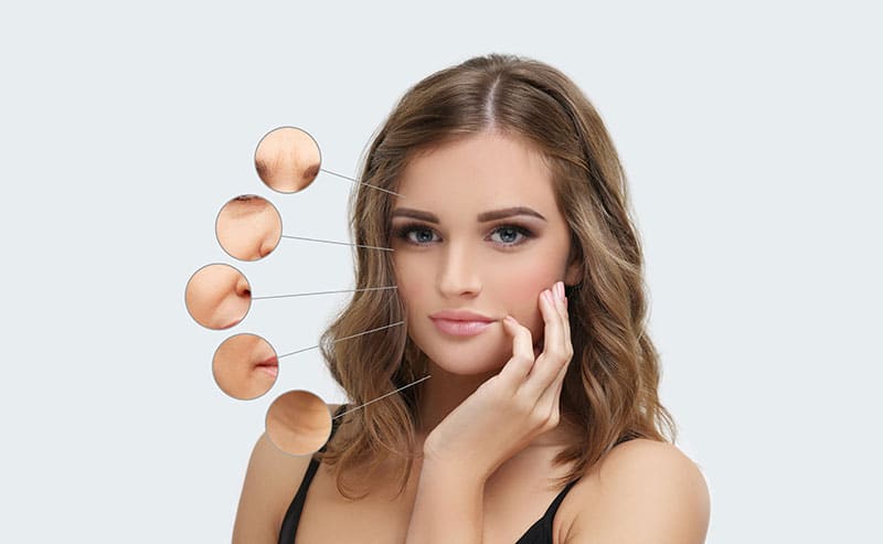 young woman with facial aging diagram